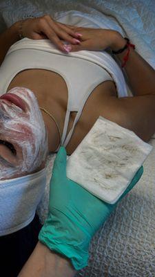 Dermaplane facial