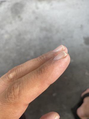 Uneven nail length and dry rough skin normally removed during a Mani