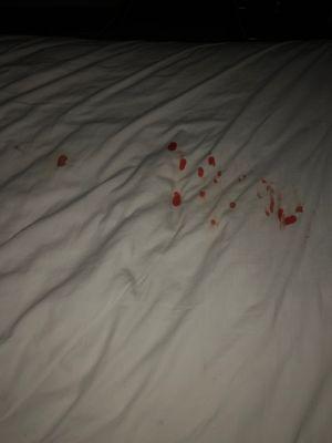 Blood stained sheets