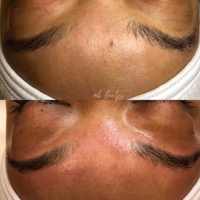 Before/After Eyebrow Touch Up