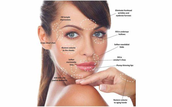 Columbia Laser and Aesthetics Center - Injectables such as Botox, Xeomin, Versa, Juvederm and much much more