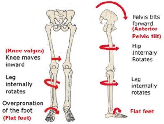 What happens when you have a tilted pelvis, also referred to as "one leg shorter than the other".