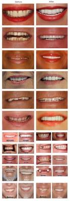 Smile Makeovers from Dr. John C. Stone