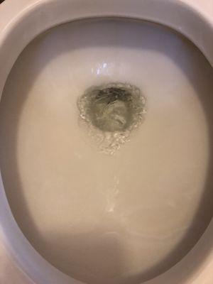 After pic of removing the dirty ring around toilet