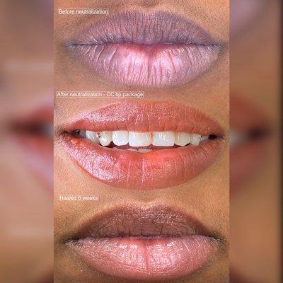 Lip Blush process for dark lip correction