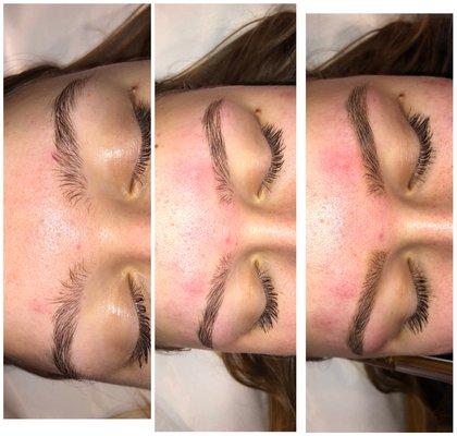 Before and after of Brows