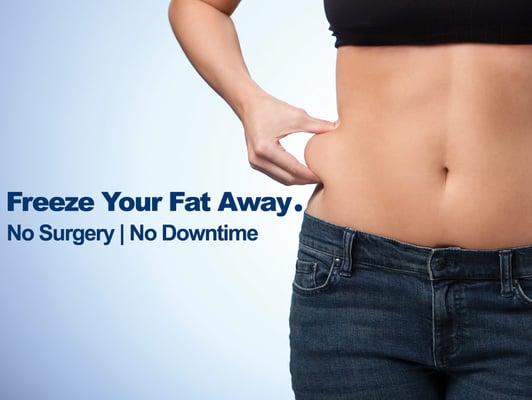 CoolSculpting