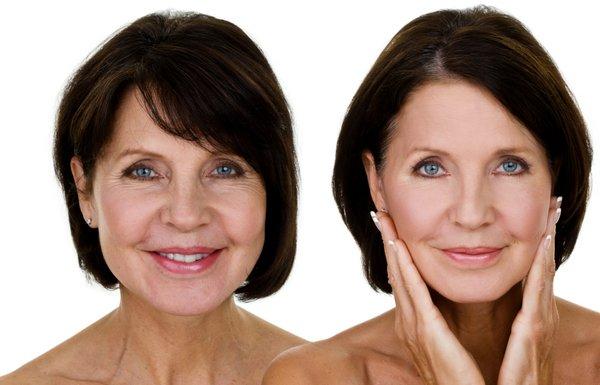 Ageless Medical Spa