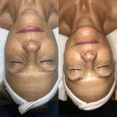 Rejuvenating Anti Aging Facial!