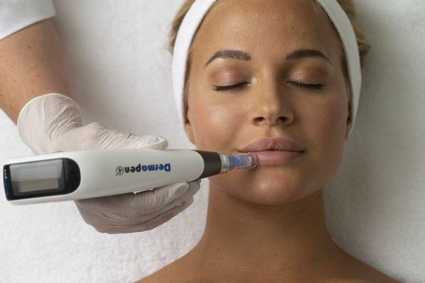 Want to step up your skincare game?! s/b studio is Certified for microneedling with Dermapen. 1000 micro channels per second!