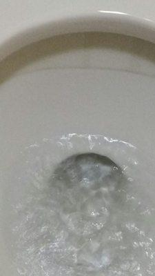 Nasty black ring in toilet bowl. Again a little cleaner and brushing would solve issue.