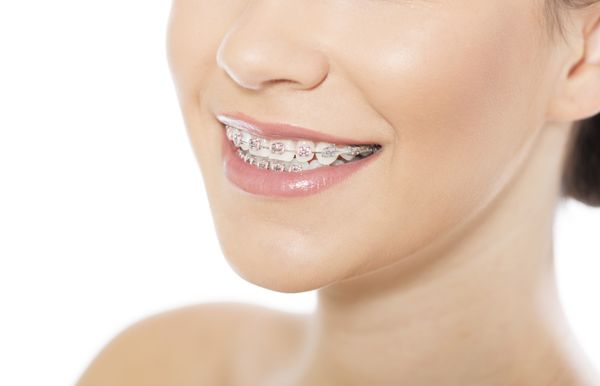 From braces to Invisalign, Dunn & Schreiber Orthodontics has the treatments to help you get a straighter, more confident smile!