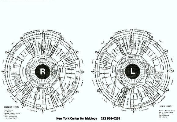 You are looking at a Clinical Iridology eye map. Every body organ enjoys its own spot in right or left iris, or sometimes both.