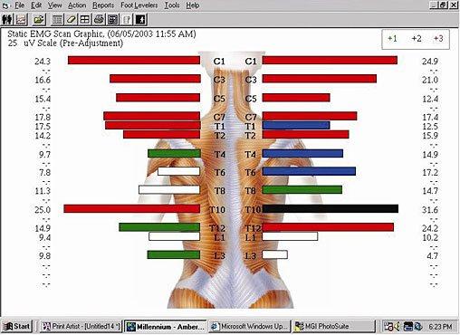 Here is a nerve scan of someone who has high levels of stress, fatigue and insomnia. How clear is your nervous system?