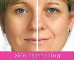 We offer SmartXide DOT Therapy, Portrait PSR, Pixel Perfect, Exilis Elite & Dermapen for skin tightening.