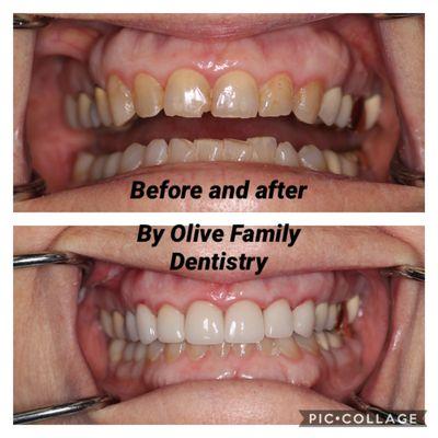 SMILE BY OLIVE FAMILY DENTISTRY