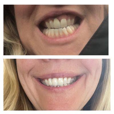 1st photo before Family Dental Group & 2nd photo after Family Dental Group