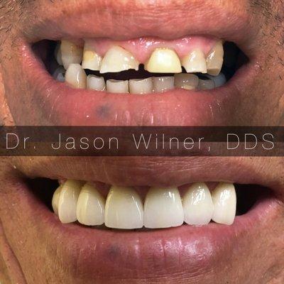 Now thats a serious smile makeover that only Dr Jason can do!