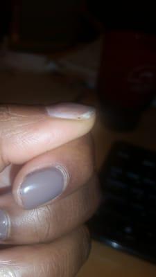 Gel polish missing from side of nail on the next day.