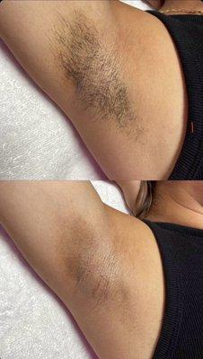 Under arm wax by Vivian