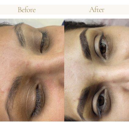 Permanent Brows. Brows are filled in permanently with pigment to create a more voluminous look for sparse eyebrows.