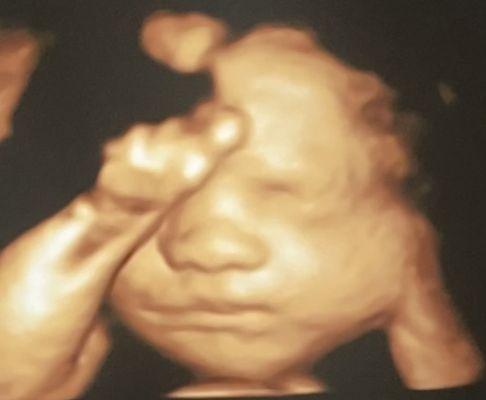 Blessings 3D 4D Ultrasound