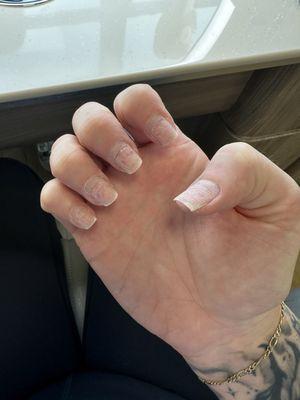 My nail bed upon professional removal of acrylic set done at C'est