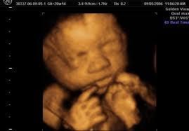 3D ultrasound shows details of your baby to be!