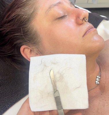 Signature Dermaplane Facial