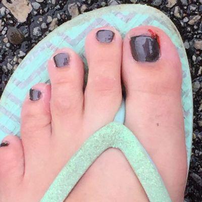 I went in for a birthday pedicure and came out with a $30 bloody toe!