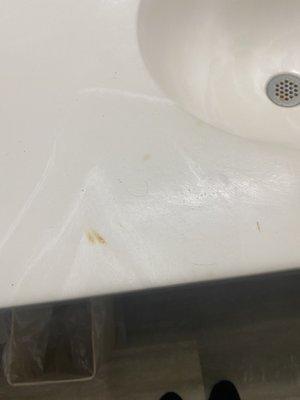 Cigarette burns on sink.