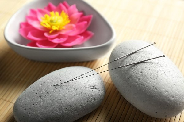 Acupuncture for Fertility helps balance hormones, improve egg and sperm quality, promote circulation to the reproductive organs