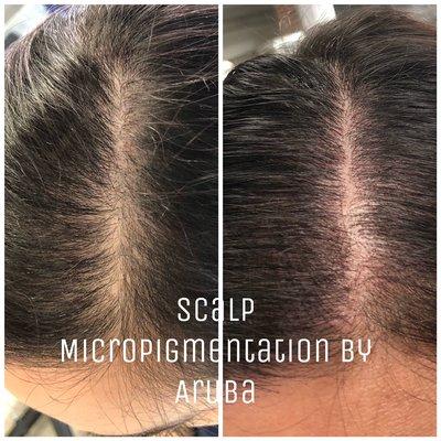 Scalp Pigmentation by Aruba