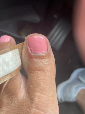 Painful toe- infected?