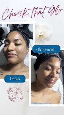 Glo2Facial for oily skin. Detox Facial