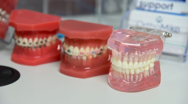 We offer Invisalign, Clear Braces, and Metal Braces in our Boca Raton office.