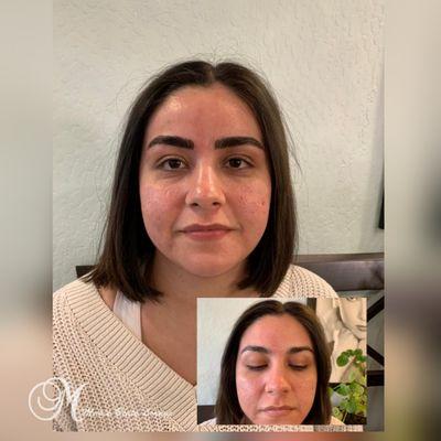 Microblading