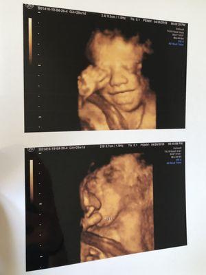 Our baby boy with his foot by his face & toes in his mouth!