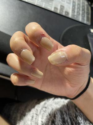 Before (gel-x done elsewhere) + dried cuticles