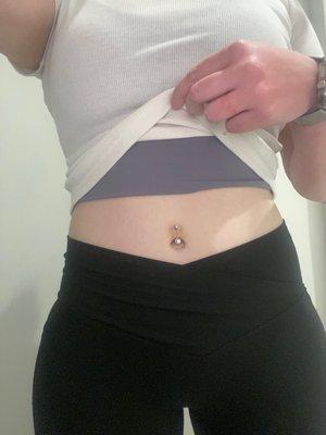 Navel piercing with slight bruising