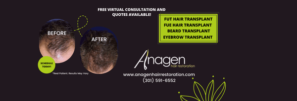 Anagen Hair Restoration