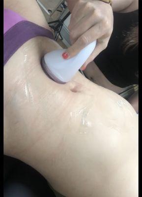 cavitation session