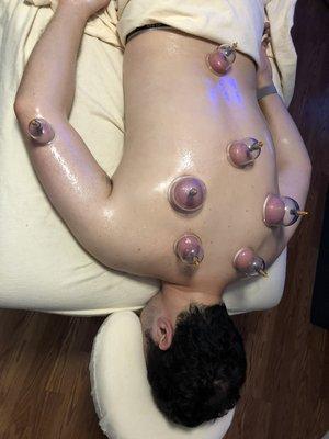 Cupping session