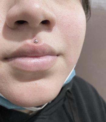 A Medusa piercing