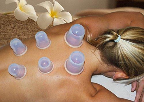 The power of cupping - a truly powerful addition to any massage service