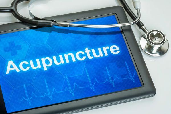 Painless and relaxing Acupuncture