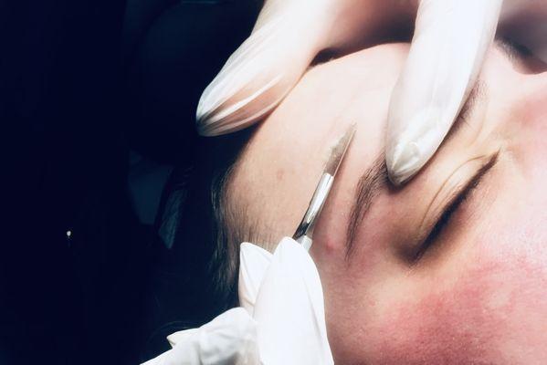 Dermaplane Facial