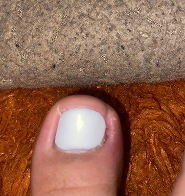 Toe swollen right side