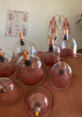 Spot treatment with cupping for specific areas.