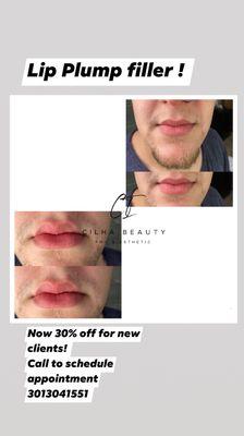 Lip Plump Filler ! Now 30% off new clients only.